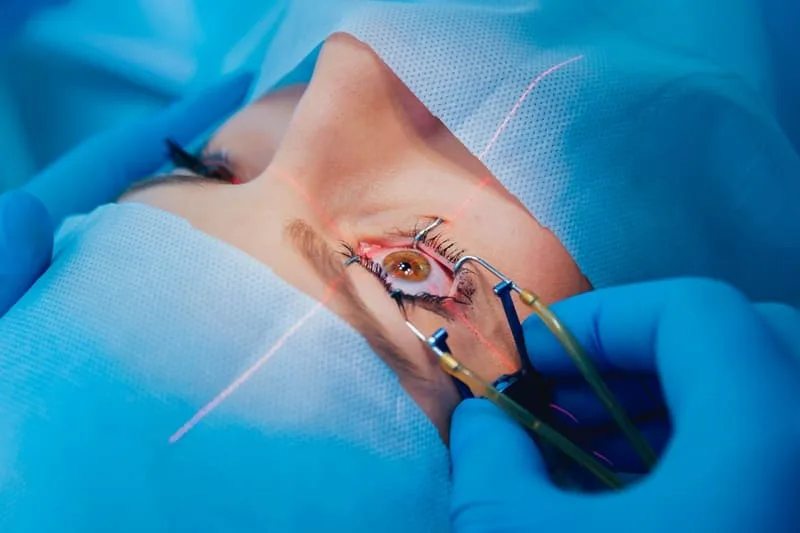 Cirugía láser ocular